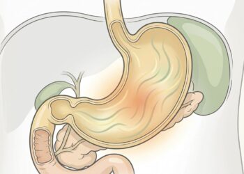 Que tipo de dor abdominal é causada por gastrite e como diferenciá-la de úlcera ou de problema na vesícula?