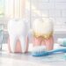Remédio natural caseiro para tártaro: receita fácil e prática para limpar os dentes em casa