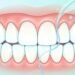 A escovação dos dentes deve durar pelo menos 2 minutos, e depois disso deve-se usar o fio dental com cuidado