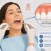Avaliar a gengiva ajuda a identificar inflamações antes que afetem a sustentação dos dentes.