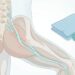 Dor lombar que desce pela perna: a pista que diferencia ciática de dor muscular comum
