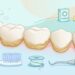 Tártaro nos dentes: por que receita caseira não substitui a limpeza profissional