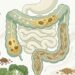 Prisão de ventre e dieta: seis dicas que podem realmente ajudar a regular o intestino e dar mais leveza