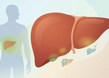 Doenças no fígado evoluem sem dor intensa e começam com sintomas leves que muita gente ignora