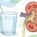 Pedra nos rins volta com frequência por um motivo simples: pouca água continua sendo o erro mais comum na prevenção