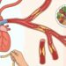 Colesterol LDL alto: os ajustes diários que mais aparecem nas diretrizes para proteger o coração