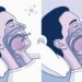 O que é a apneia do sono e como identificar os sinais?