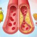 Quais são os efeitos do consumo de frituras, gorduras e ultraprocessados em pessoas com colesterol alto?