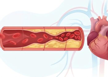 Colesterol alto: por que ele costuma ser silencioso e como protegê-lo a tempo