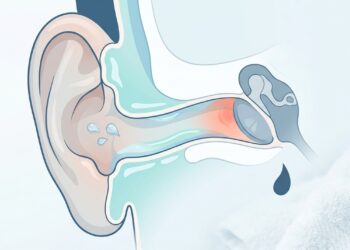 A dor de ouvido por água é muito diferente da dor de uma infecção