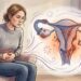 Endometriose: o que é, como é detectada e quais são as opções de tratamento