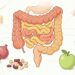O que é a síndrome do intestino irritável e como identificar os sinais?