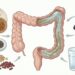 Intestino preso por dias não se resolve só com mais água: as fibras com melhor evidência para constipação crônica