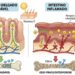 Falta de vitamina D nem sempre é pouco sol: intestino inflamado e má absorção também entram na conta