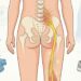 Dor lombar que desce pela perna: a pista que diferencia ciática de dor muscular comum