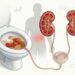 4 sintomas de danos renais visíveis ao urinar