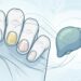 Doenças hepáticas também são claramente visíveis nas unhas: fique atento a esses sinais.