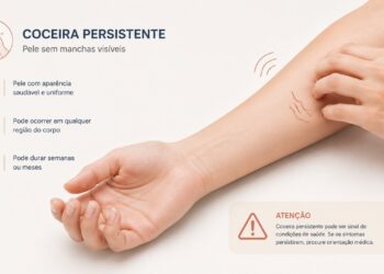 Coceira no corpo sem manchas pode exigir investigação quando é persistente.