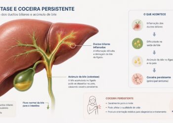 Alterações nos ductos biliares podem causar coceira persistente e cansaço.