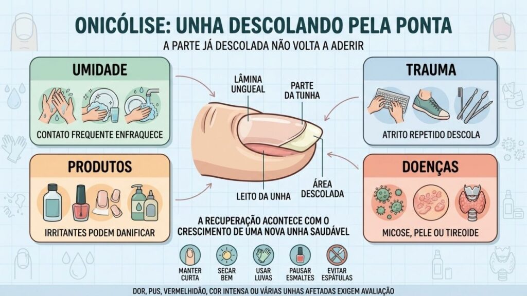 Umidade, trauma, produtos e doenças estão entre as causas da onicólise.