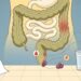 As fezes vêm com sangue vivo de vez em quando, mas some sozinho? O intestino pode estar sinalizando algo que precisa ser visto