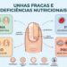 Qual deficiência de nutriente está ligada a unhas fracas e quebradiças