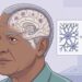Uma investigação mostra que pessoas com doença de Alzheimer apresentam níveis mais elevados de alumínio no tecido cerebral