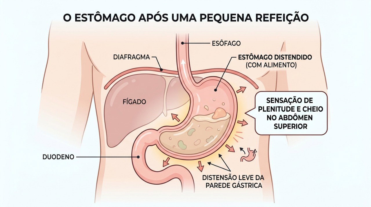 Saciedade precoce, estufamento e desconforto após comer podem aparecer na dispepsia.