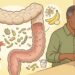Como reduzir a inflamação intestinal naturalmente para aliviar o inchaço e o desconforto da colite