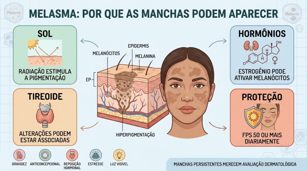 Luz, hormônios, tireoide e fotoproteção ajudam a explicar a evolução do melasma.