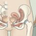 Como fortalecer a musculatura pélvica naturalmente para aliviar as perdas urinárias e a urgência da incontinência