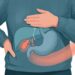 Dor na parte de cima da barriga depois de comer não é só má digestão e pode ter relação com a vesícula