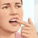Dente permanente que começa a ficar mole pode indicar perda de sustentação causada por doença periodontal.