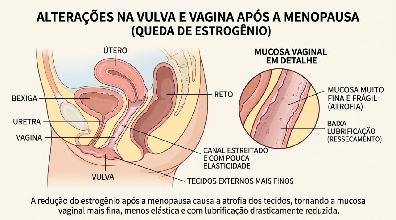 A queda do estrogênio pode deixar os tecidos vaginais mais secos, finos e sensíveis.
