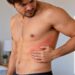 Ardor, dor ou formigamento em faixa de um lado do corpo podem aparecer antes das bolhas do cobreiro.