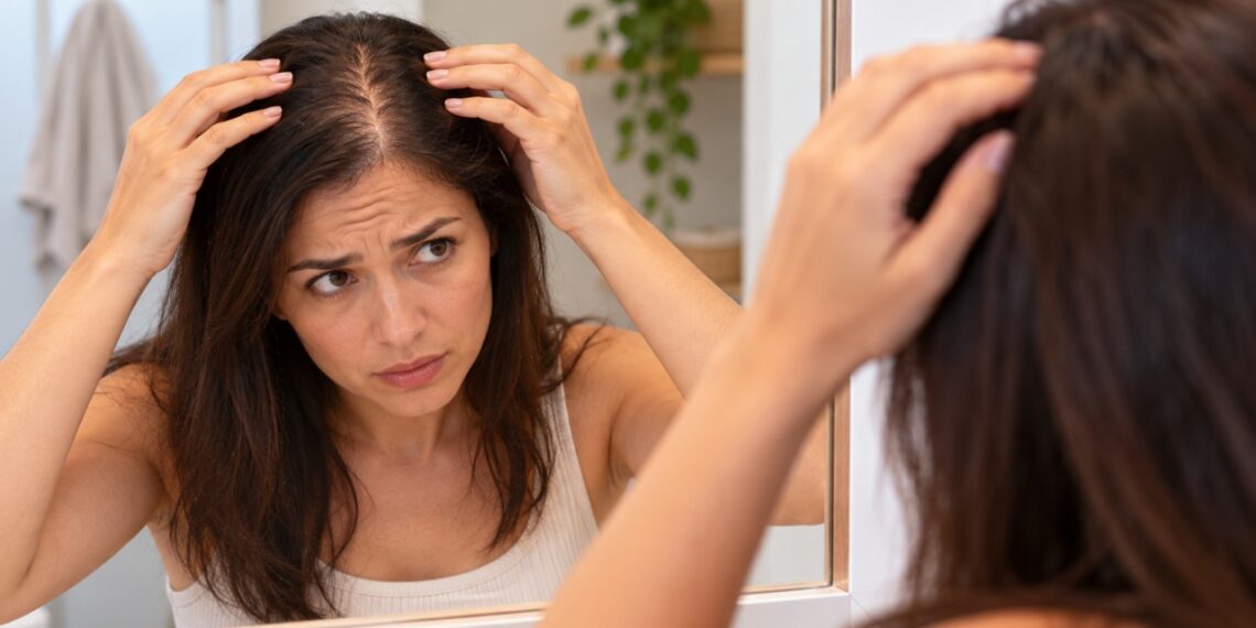 Uma risca cada vez mais larga pode ser um dos primeiros sinais de afinamento progressivo do cabelo.
