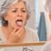Placas brancas na língua e dentro da boca podem indicar candidíase oral, especialmente quando acompanhadas de ardor e irritação.