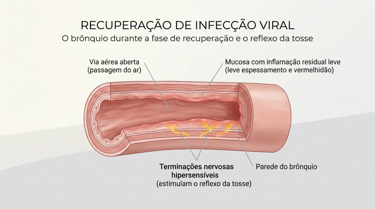 A inflamação residual e a maior sensibilidade dos brônquios podem manter a tosse mesmo após a melhora da gripe.