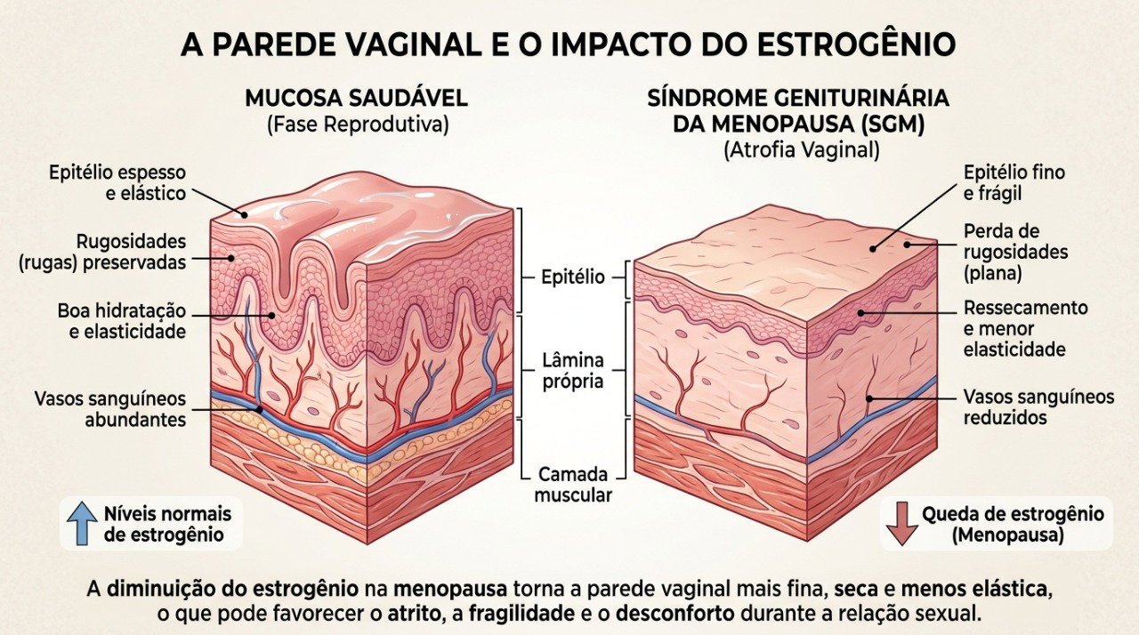 A redução do estrogênio após a menopausa pode tornar a mucosa vaginal mais fina, menos hidratada e sensível ao atrito.