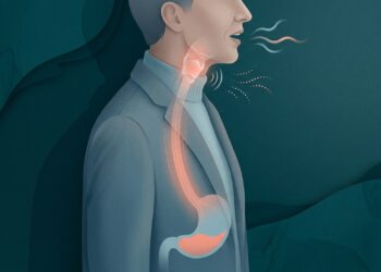 Rouquidão que não passa mesmo sem gripe pode ser um alerta silencioso de refluxo