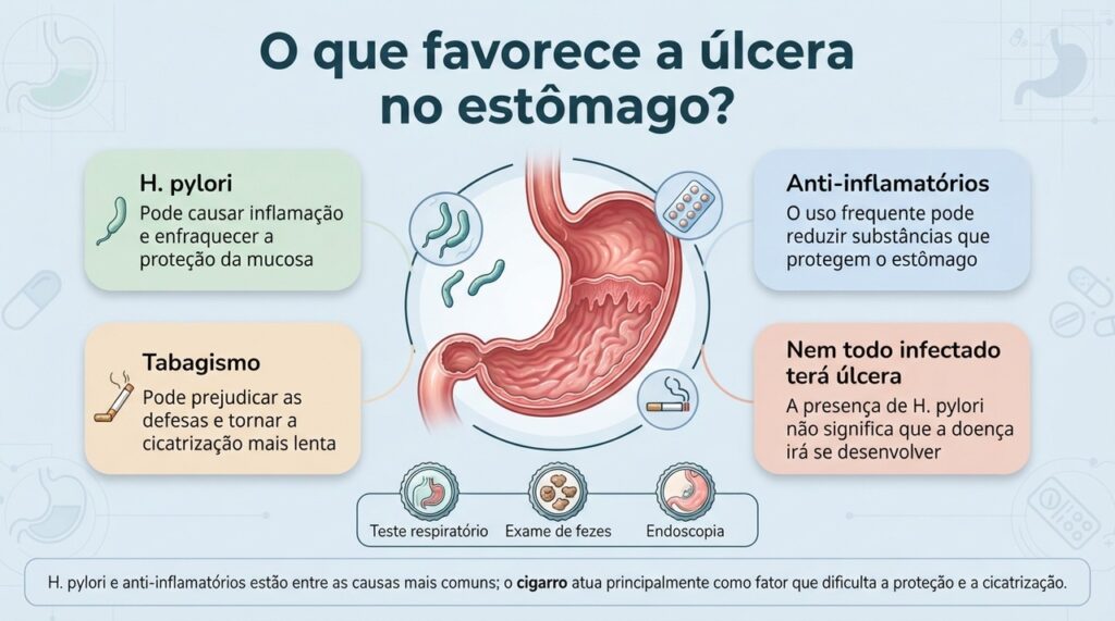 H. pylori e anti-inflamatórios têm papel central na úlcera gástrica, enquanto o tabagismo pode prejudicar a proteção e a cicatrização do estômago.