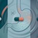 Omeprazol, pantoprazol ou esomeprazol: entenda a diferença entre os remédios para gastrite e refluxo