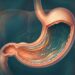 Como a bactéria H. pylori se instala no estômago e por que ela é tão comum