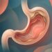 H. pylori pode passar despercebida? O que o corpo pode sentir quando o estômago fica inflamado